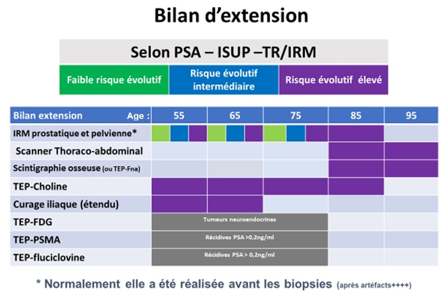Bilan d'extension du cancer de la prostate : les examens possibles dans un tableau récapitulatif