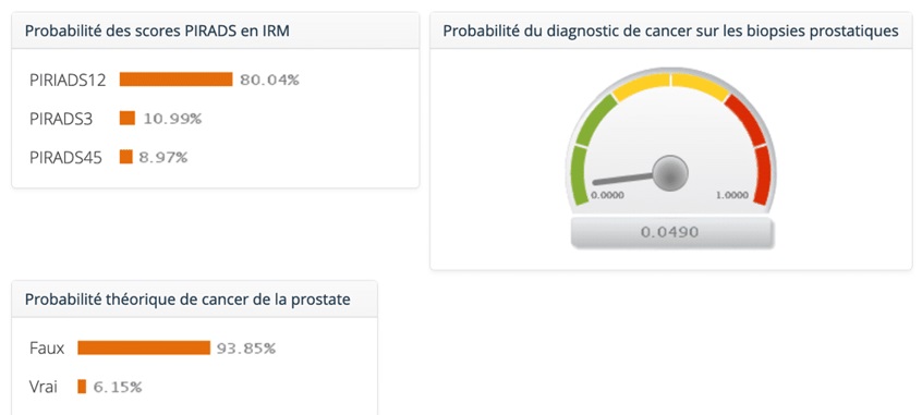 Exemple de resultat outil IA simulateur diagnostic du cancer de la prostate