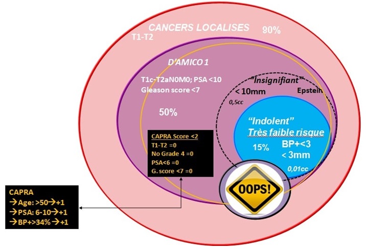 Illustration du classement des cancers de prostate localises