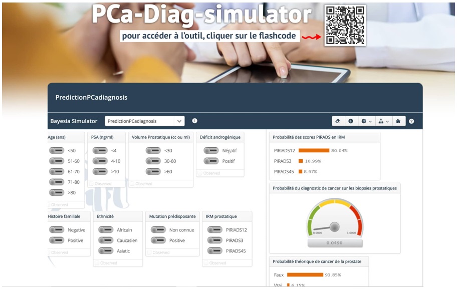 Visuel outil IA simulateur diagnostic du cancer de la prostate
