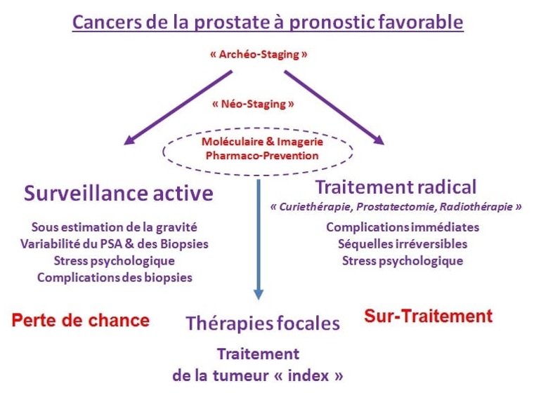 Place des thérapies focales pour cancer de prostate et importance du staging
