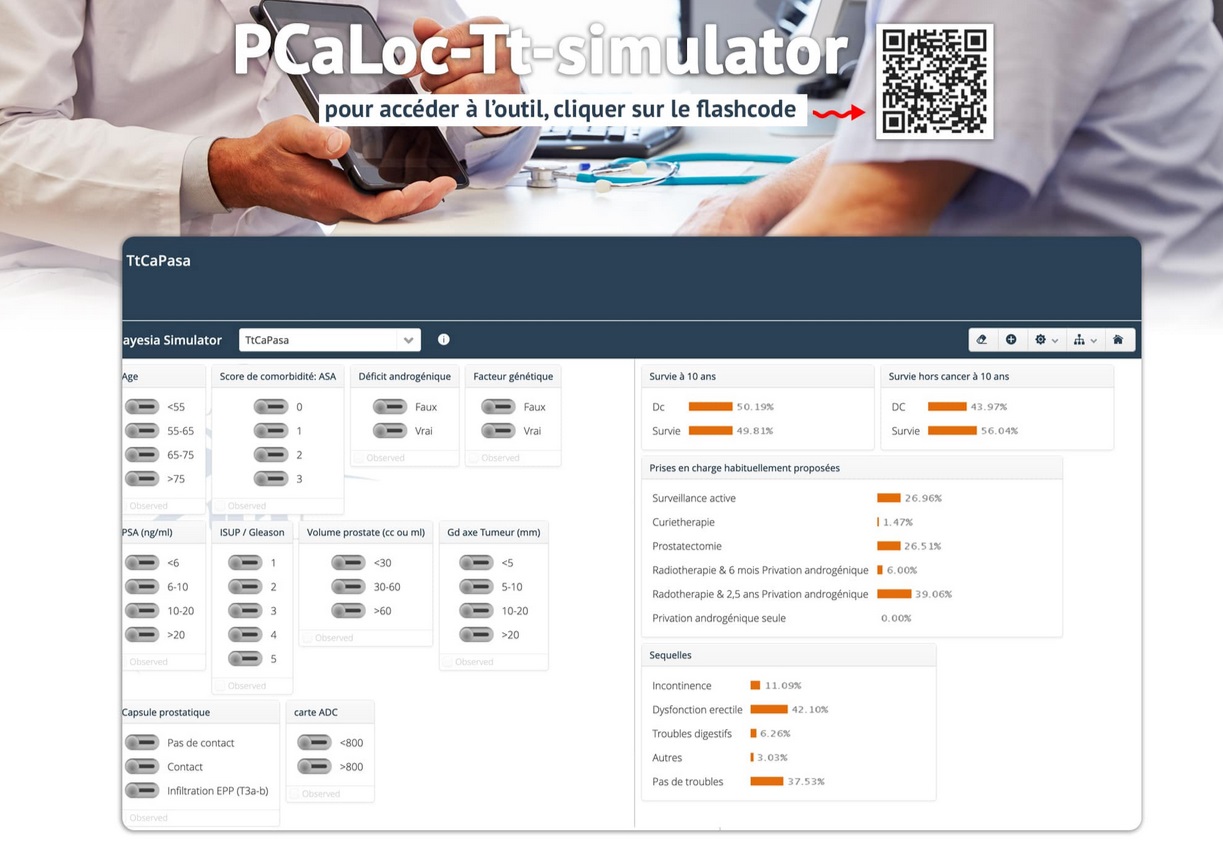 Visuel outil IA simulateur aide decision au choix des traitements du cancer de prostate localisé